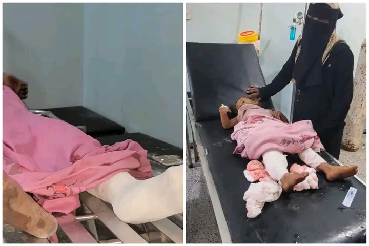 إصابة طفلتين جراء استهداف حوثي قرية ماشعة شمالي حيس